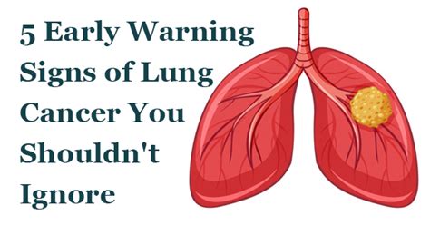 Early Warning Signs Of Lung Cancer You Shouldn T Ignore Affordable Radon Colorado