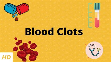 How To Treat Blood Clot In Heart Aljazeera Medical Center