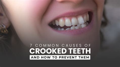7 Common Causes Of Crooked Teeth By Springvale Dental Clinic