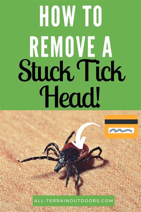 How To Remove A Tick Head Stuck In Skin 2021