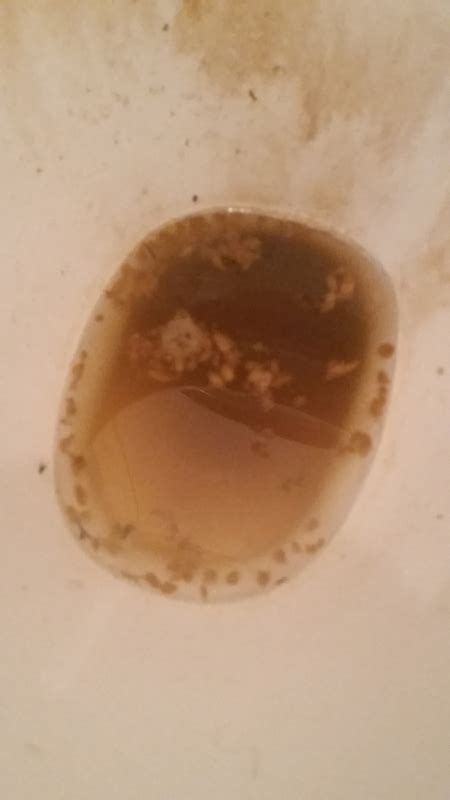 White Tissue In Stool Cancer Mucus Stringy Poo Bowel Abnormalities Rectal Youmemindbody
