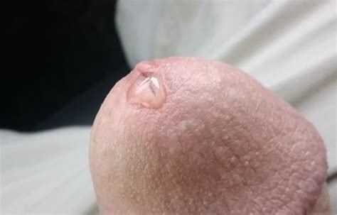 My Thick Cock Head Close Up And Personal 13 Pics Xhamster