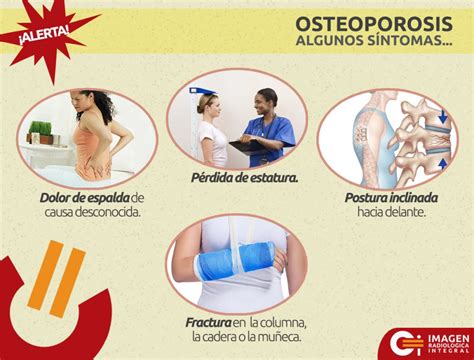 Sintomas De La Osteoporosis Infografía