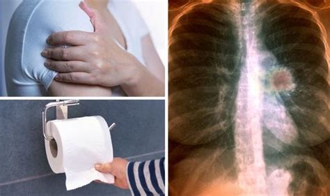 Lung Cancer Symptoms 10 Unexpected Signs Of A Lung Tumour You Might