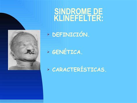 Características Da Síndrome De Klinefelter Edubrainaz