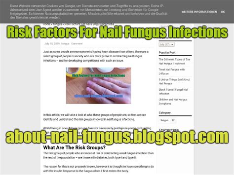 Risk Factors Nail Fungus Infections Toenail Fungus Remedies Nail
