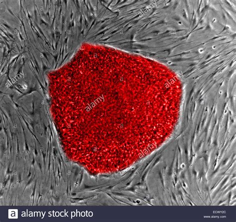 Light Micrograph Human Cells Hi Res Stock Photography And Images Alamy
