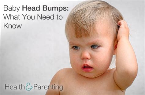 Baby Head Bumps What You Need To Know Health And Parenting