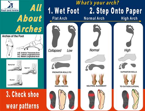 all about arches infographic podiatry content patient education portsmouth foot and