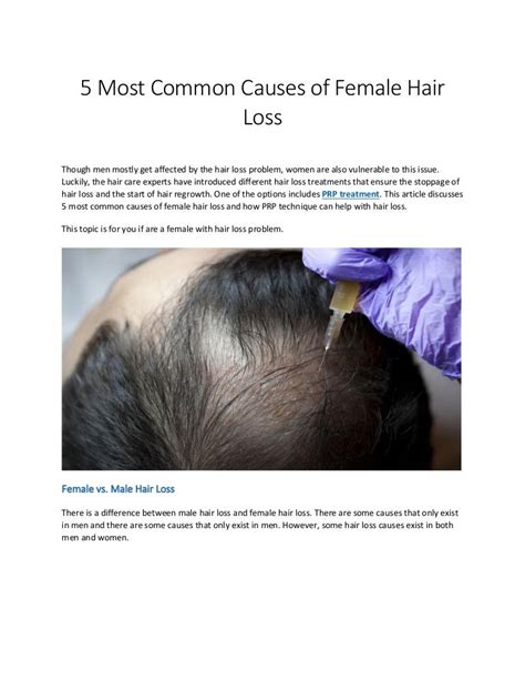 5 Most Common Causes Of Female Hair Loss
