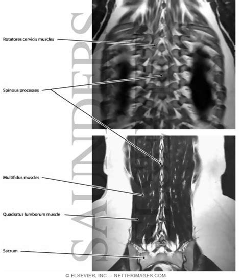 These muscles are divided into superficial and intermediate. Deep Muscles of the Back