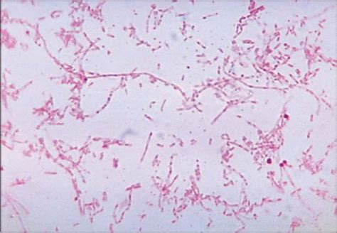Enterobacter Gram Stain Results