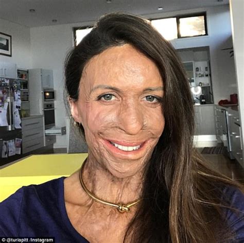 Pregnant Burns Survivor Turia Pitt Shares Video Recovery Daily Mail
