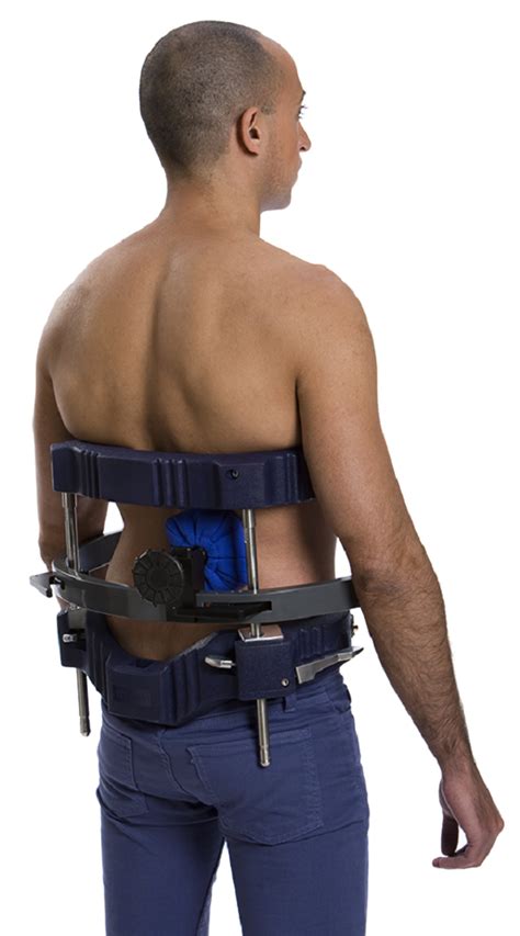 Dbs Dynamic Brace System For Scoliosis