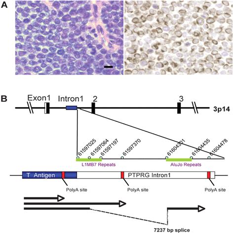 Clonal Integration Of A Polyomavirus In Human Merkel Cell Carcinoma