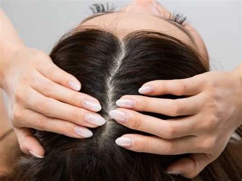 Acne On Scalp This Is How You Can Cure It