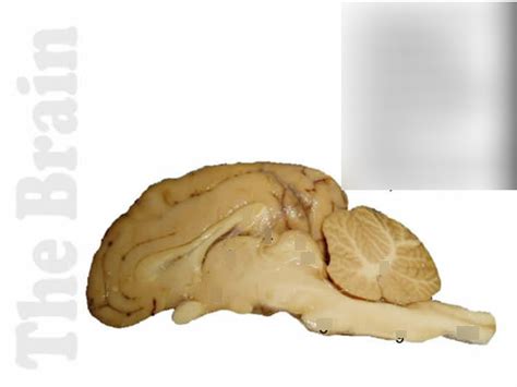 Gross Neuroanatomy Diagram Quizlet