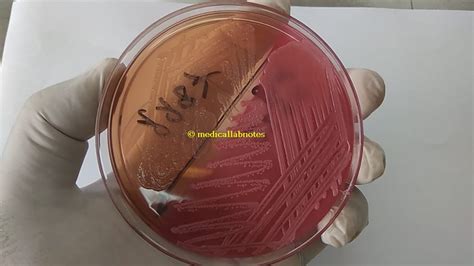 Lactose Fermenter Lf And Non Lactose Fermenter Nlf Gram Negative