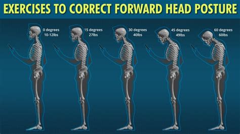 Fix Forward Head Posture