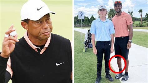 What Happened To Tiger Woods Leg In Accident Nayag News
