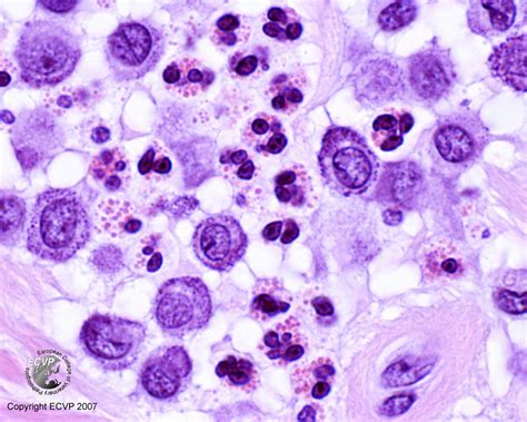 Mast Cell Tumor 中文 Mast Cell Marker Muwhenn