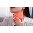 Signs And Symptoms Of A Sore Throat & Tonsillitis  ENEWS 20
