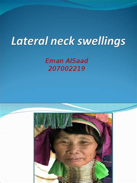 Lateral Neck Swelling Neck Lymphatic System