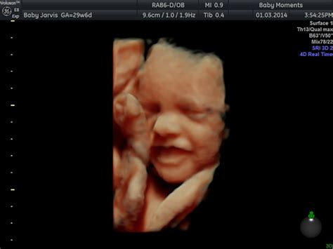 Category Pregnancy Scan Baby Moments 4d Pregnancy Scan