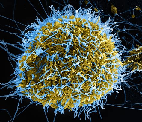 Scientists also call it filovirus. Post-Ebola virus syndrome - Wikipedia