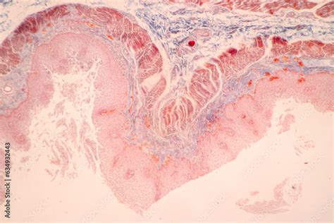 Showing Light Micrograph Of The Sublingual Gland Oesophagus Human And
