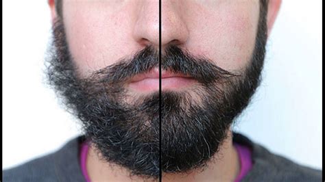 What Are Hair Growth Supplements To Make Facial Hair Grow Faster Youtube