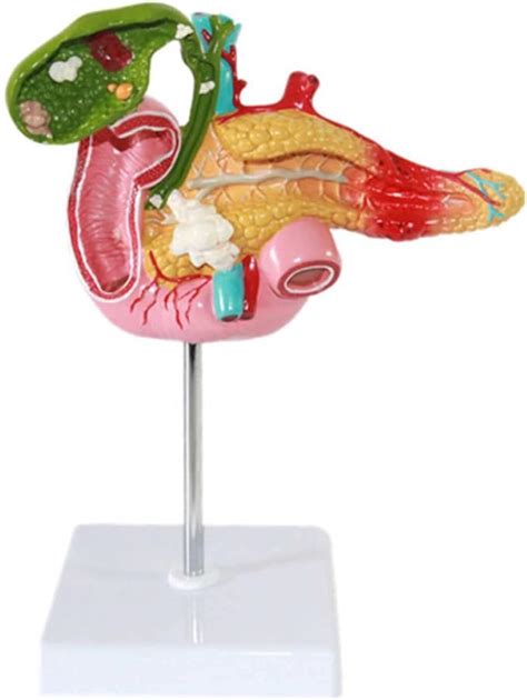 Teaching Model Pancreas Model Pancreas Duodenum Life Size Spleen My