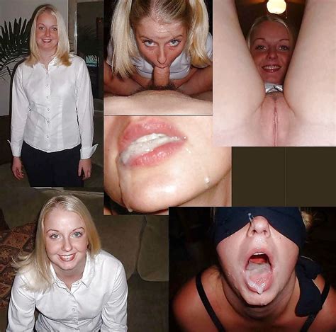 Amateur Before And After Facial Collection Pics XHamster