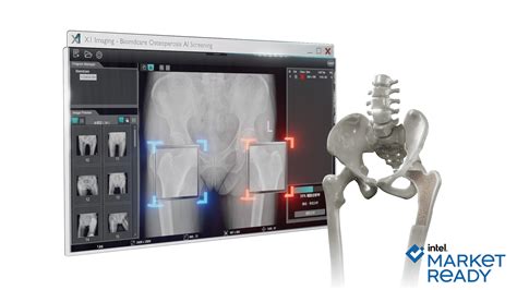 Biomedica X1 Imaging Solution