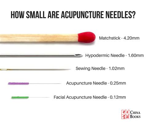 Acupuncture Needle Size Health In Flow