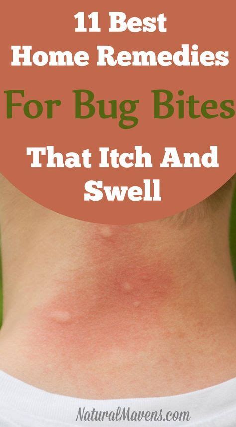 Stop Itching And Swelling With These Natural Home Remedies For Bug