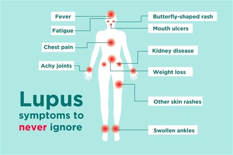 Lupus Signs And Symptoms How To Tell If You Could Have Lupus