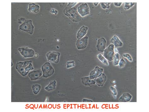 * to culture epithelial cells, a urine sample is first centrifuged. CME Slides Forum - G.B. Fogazzi