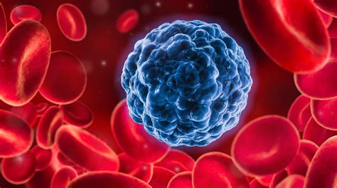 Metall-Chemotherapien können Immuntherapien bei Krebs verstärken