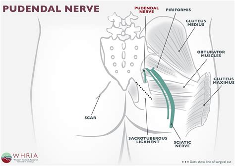 Pudendal Nerve Dermatome Male Dermatomes Chart And Map