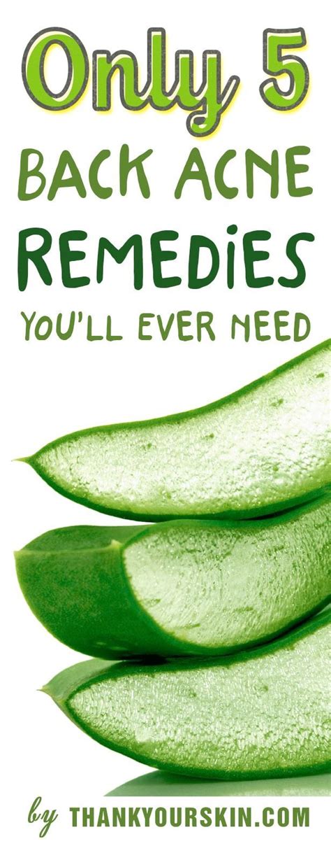 The Only 5 Back Acne Remedies Youll Ever Need How To Get Rid Of