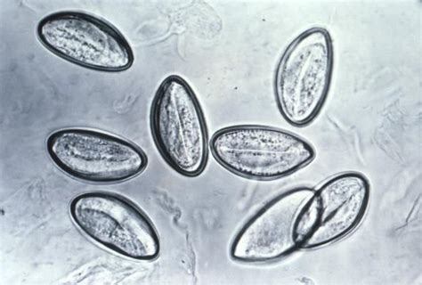 Eggs of Enterobius vermicularis pinworm Microbiología Tecnología
