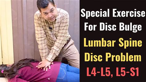 Special Exercise For Disc Bulge Lumbar Disc Bulge Treatment Herniated