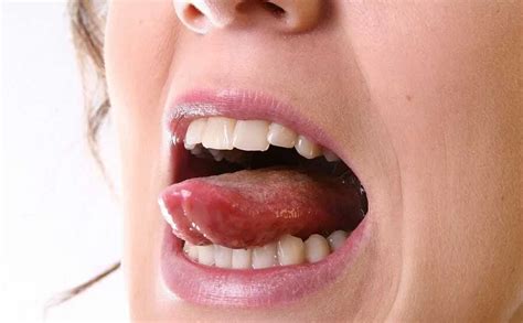 Боль во рту и на языке причины симптомы и лечение