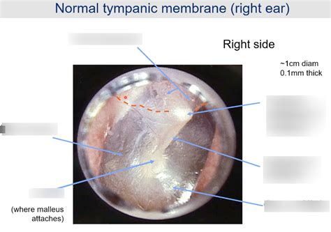 Tympanic Membrane Diagram Quizlet