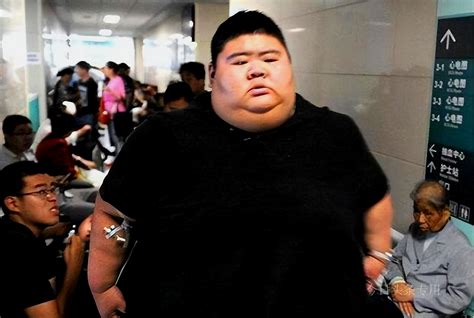 Wang Haonan The Fattest Person In China Lost 480 Pounds For Love After Becoming Famous He