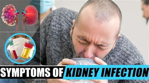 Kidney Infection Most Common Signs And Symptoms Of Kidney Infection