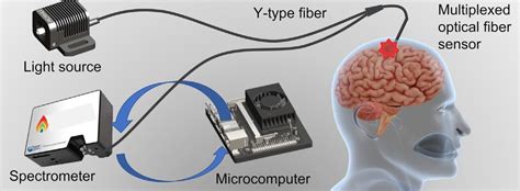 New Ai Enabled Optical Fibre Sensor Device Could Help Monitor Brain