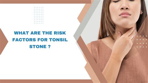 What Are The Risk Factors For Tonsil Stone By Medrec Hospital