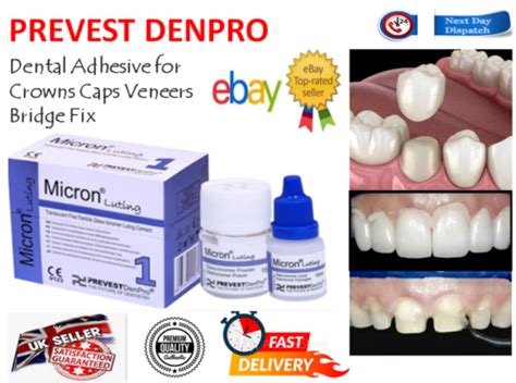 Mastermedi Zinc Oxide Eugenol Cement Dental Care Kit Glue For Crowns